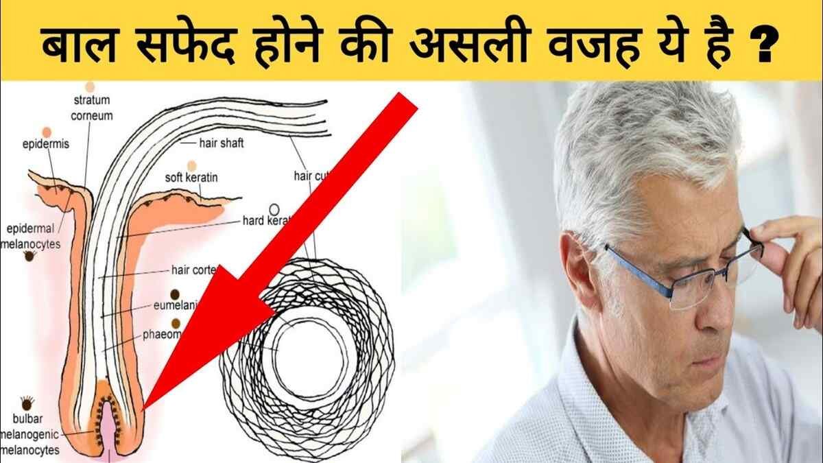 विज्ञान ने बताया बाल सफेद क्यों हो जाते हैं? | Why does hair turn white?